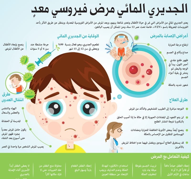 انتشار مرض الجديري المائي بين الطلاب في عدد من المدارس بالمحافظات