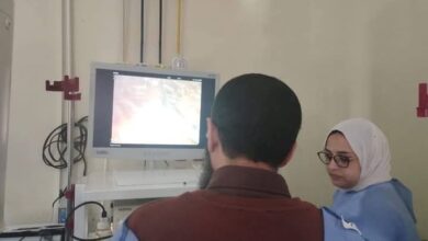 مستشفيات جامعة أسيوط تنجح فى إجراء عملية تفتيت حصوات في القنوات المرارية