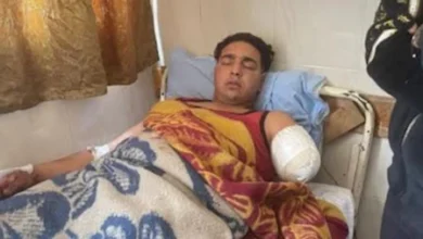 أول ظهور لعامل سيرك طنطا بعد بتر ذراعه