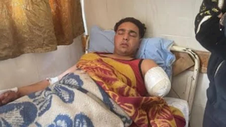أول ظهور لعامل سيرك طنطا بعد بتر ذراعه