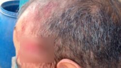 محاكمة المتهم بالتعدي على مدرس بالمقص في الإسماعيلية اليوم