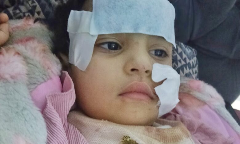 إخلاء سبيل لوبا الحلو بكفالة 20 ألف جنيه بعد 8 ساعات تحقيق في هجوم شبل السيرك