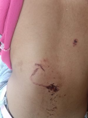 «الكرنك في خطر».. هجوم كلب على طفلة يفتح ملفًا سبق أن حذر منه الأهالي