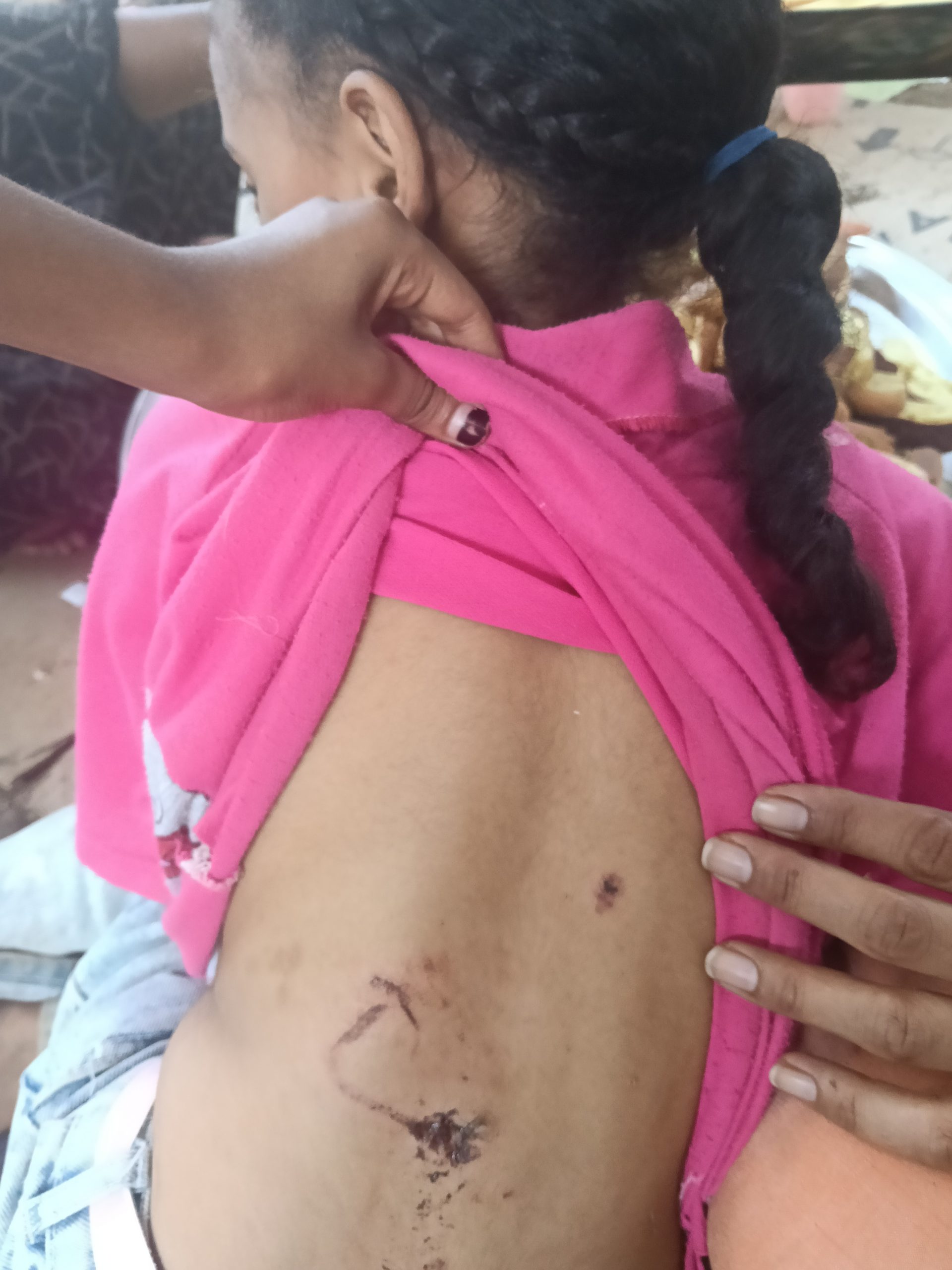 «الكرنك في خطر».. هجوم كلب على طفلة يفتح ملفًا سبق أن حذر منه الأهالي