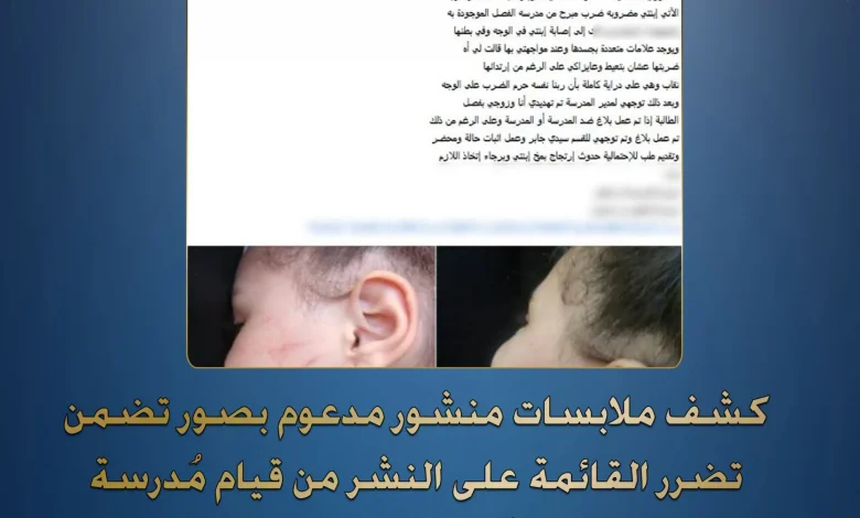  مُدرسة قامت بالتعدى على نجلتها وإحداث إصابات حال تواجدها داخل مدارس بالإسكندرية