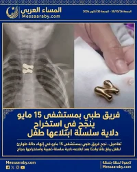 فريق طبي بمستشفى 15 مايو ينجح في استخراج دلاية سلسلة ابتلاعها طفل